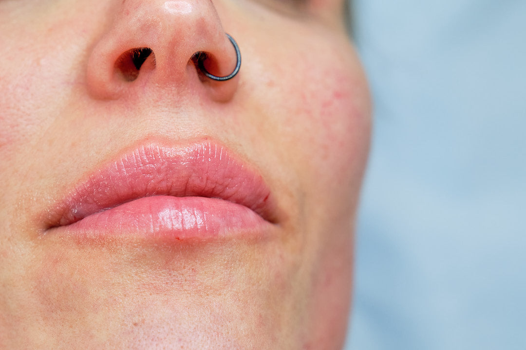 TRATAMIENTO DE LABIOS con Acido Hialuronico